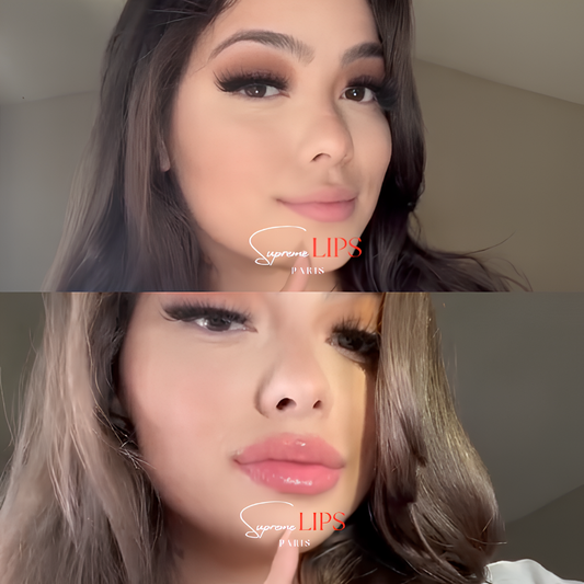 PAKIET DUO SUPREME LIPS POWIĘKSZACZ DO UST